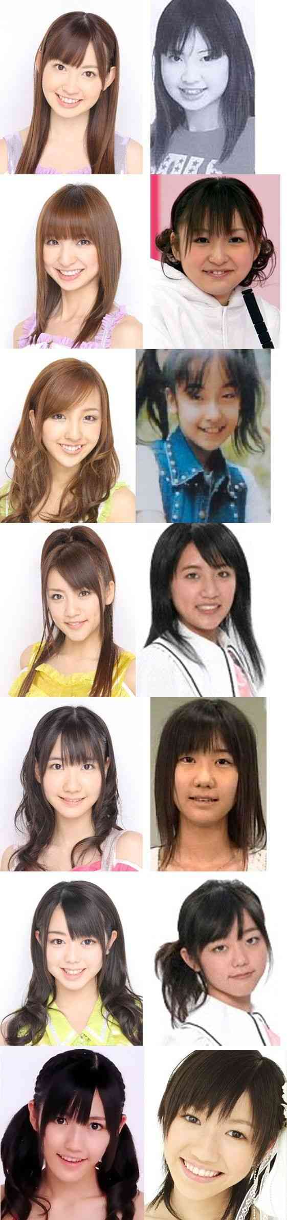 「まぶたのおさいほう」って!? アイドル・フラップガールズスクールの佐藤優香の斬新すぎる整形告白が話題に