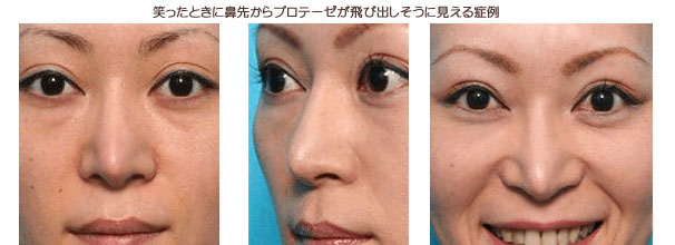 太眉 vs 細眉