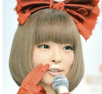 きゃりーぱみゅぱみゅ、酔って転倒し後頭部7針縫う大ケガしていた
