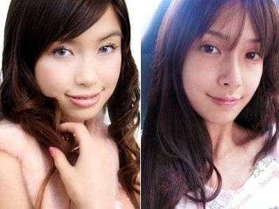 整形し過ぎたと思う有名人