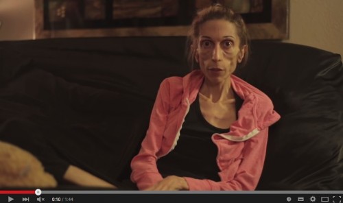 体重18キロの摂食障害の女性が助けを求める動画が話題　支援金は2000万円以上に