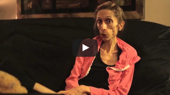 体重18キロの摂食障害の女性が助けを求める動画が話題　支援金は2000万円以上に