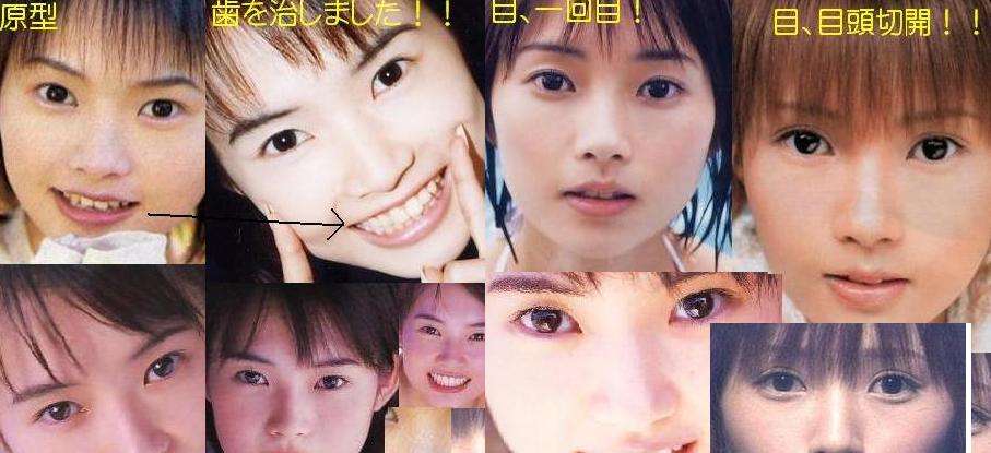 整形し過ぎたと思う有名人