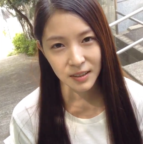 整形し過ぎたと思う有名人