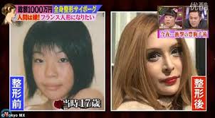 整形し過ぎたと思う有名人