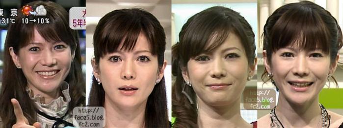 整形し過ぎたと思う有名人