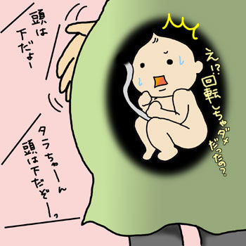 妊娠中の逆子