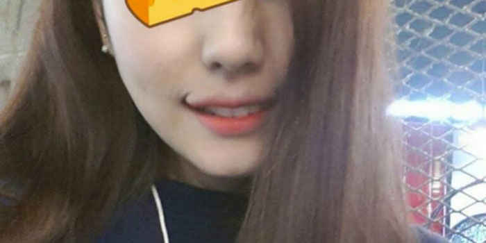 整形大国韓国で、“永遠の笑顔”を手に入れるための口角切開手術が流行中!? - IRORIO（イロリオ）