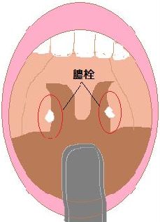 「臭い玉」出る人！