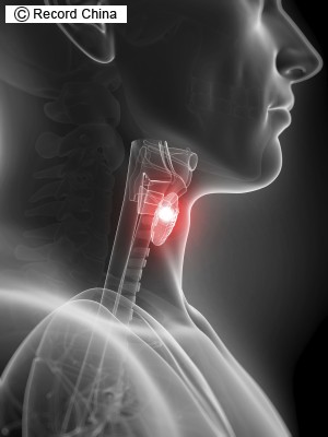 韓国、原発による甲状腺がん被害で住民が集団訴訟＝電力会社...：レコードチャイナ