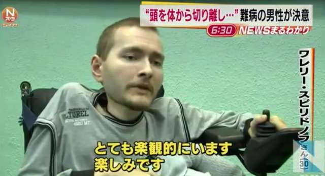 「頭を体から切り離し他人と結合」難病男性が手術へ