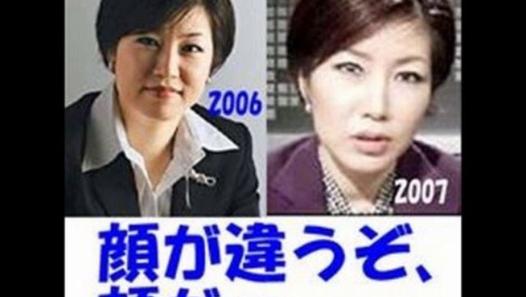 整形したことを後悔してる人