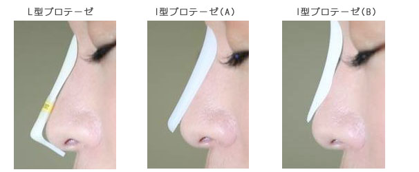 鼻プロテぽい芸能人