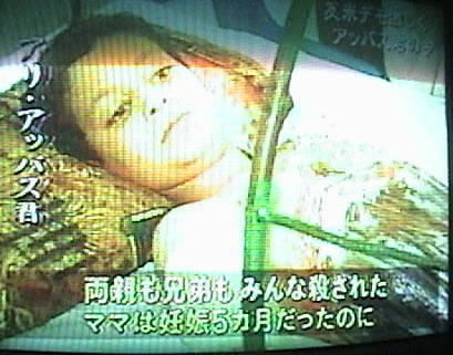 【閲覧微注意】手足を失った元兵士の写真集。肉体美が伝える「戦争」という現実