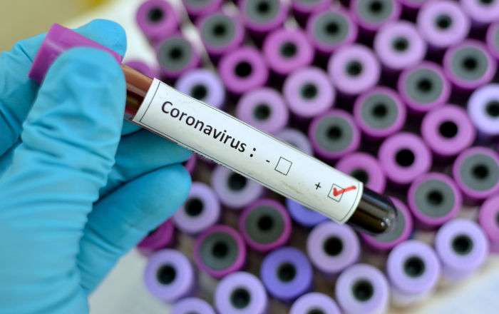 ロシアはMERSに対する初の国産ワクチンの登録を行っている / Sputnik 日本