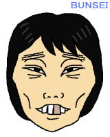 前歯に虫歯のある方！！