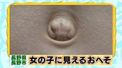 産後、おへその形がブサイクになった人ー!!