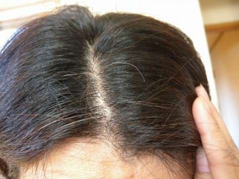 若白髪 白髪に悩んでいるかた ガールズちゃんねる Girls Channel