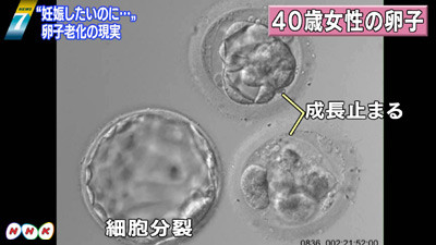 体外受精 治療受けた女性の4割超が40歳以上…妊娠を後回しにしてキャリアを積んだ女性増加
