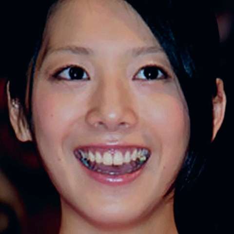 歯が綺麗な有名人