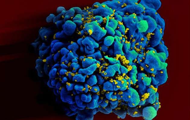 米大学研究者がヒト細胞からHIVウイルスの根絶に成功、エイズ完治に道。ゲノム編集技術を活用 - Engadget Japanese