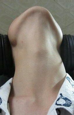 【閲覧注意】…じゃなかった画像