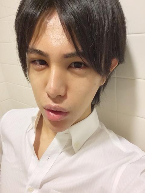 『今夜くらべてみました』に出演した整形男子・アレンが色々スゴイ