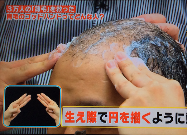 白髪になりにくい方