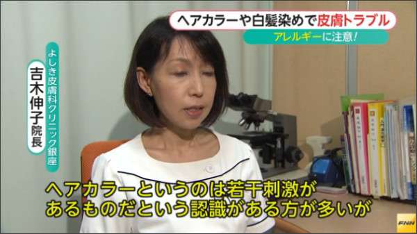 毛染めで皮膚トラブル相次ぐ 定期的なパッチテストが必要