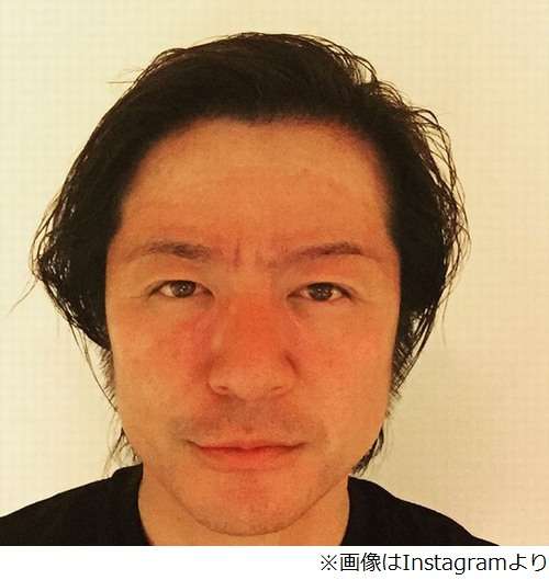 GLAY・TERUの顔が「ヤバイ…」、数日後に撮影も「焼けすぎた（笑）」。