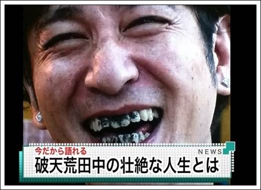 芸能人の黒歴史