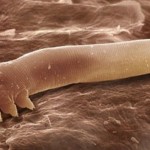 【ニキビや肌荒れの原因？】顔ダニの駆除方法 | デュアルラボ！