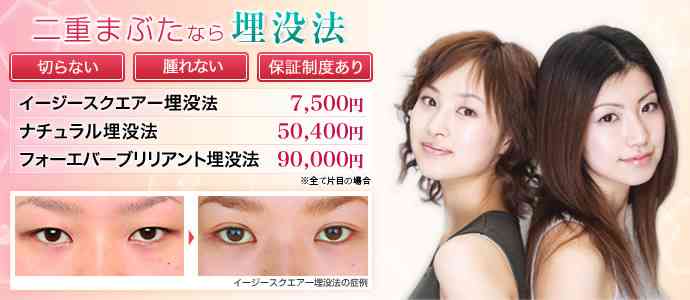 整形した方に質問です!(暴露しましたか?)