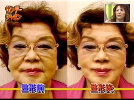 二重以外を整形している芸能人