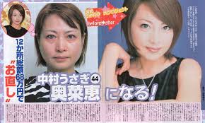 二重以外を整形している芸能人