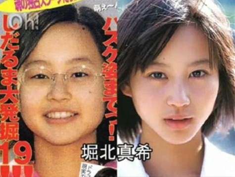 二重以外を整形している芸能人
