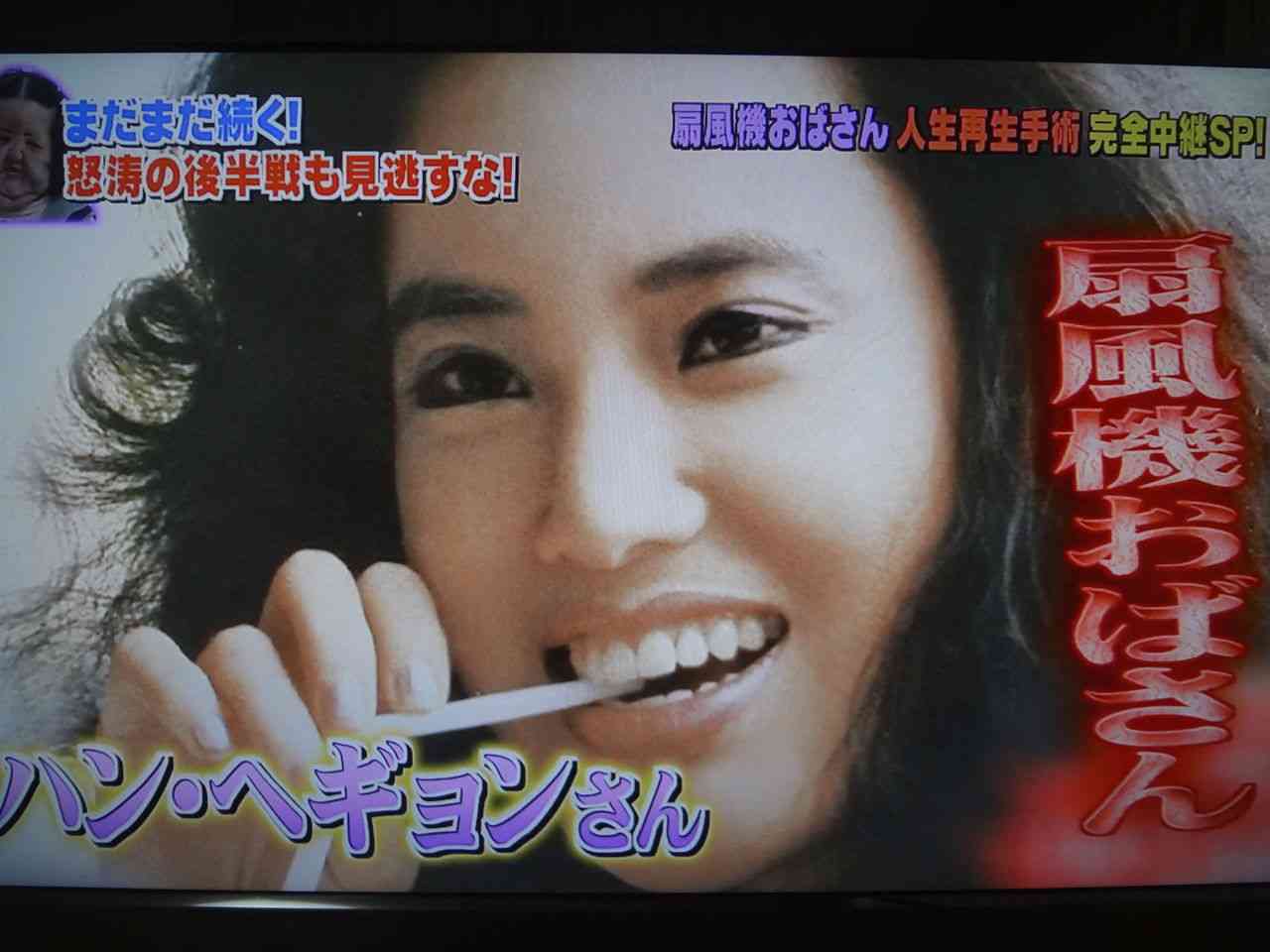 美容整形で失敗した方いますか？
