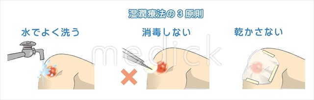 バイオイル使ってる人