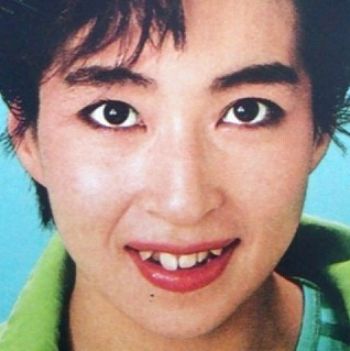 二重以外を整形している芸能人