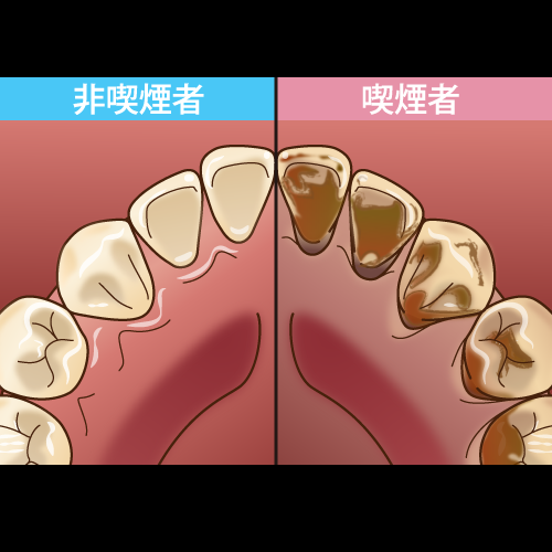 女性の喫煙率上昇、冷たい視線と同情の声「やめたいけどやめられない…」悩ましい本音