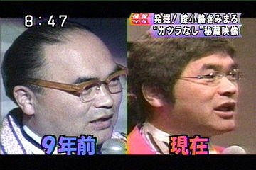 有名人！残念な髪型選手権！