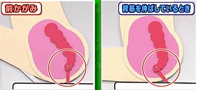 便秘続いて苦しい方一緒に嘆きましょう