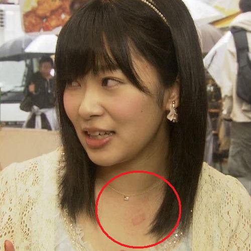 HKT48指原莉乃の美脚ショットに心配の声「さっしーはいてますか!?」