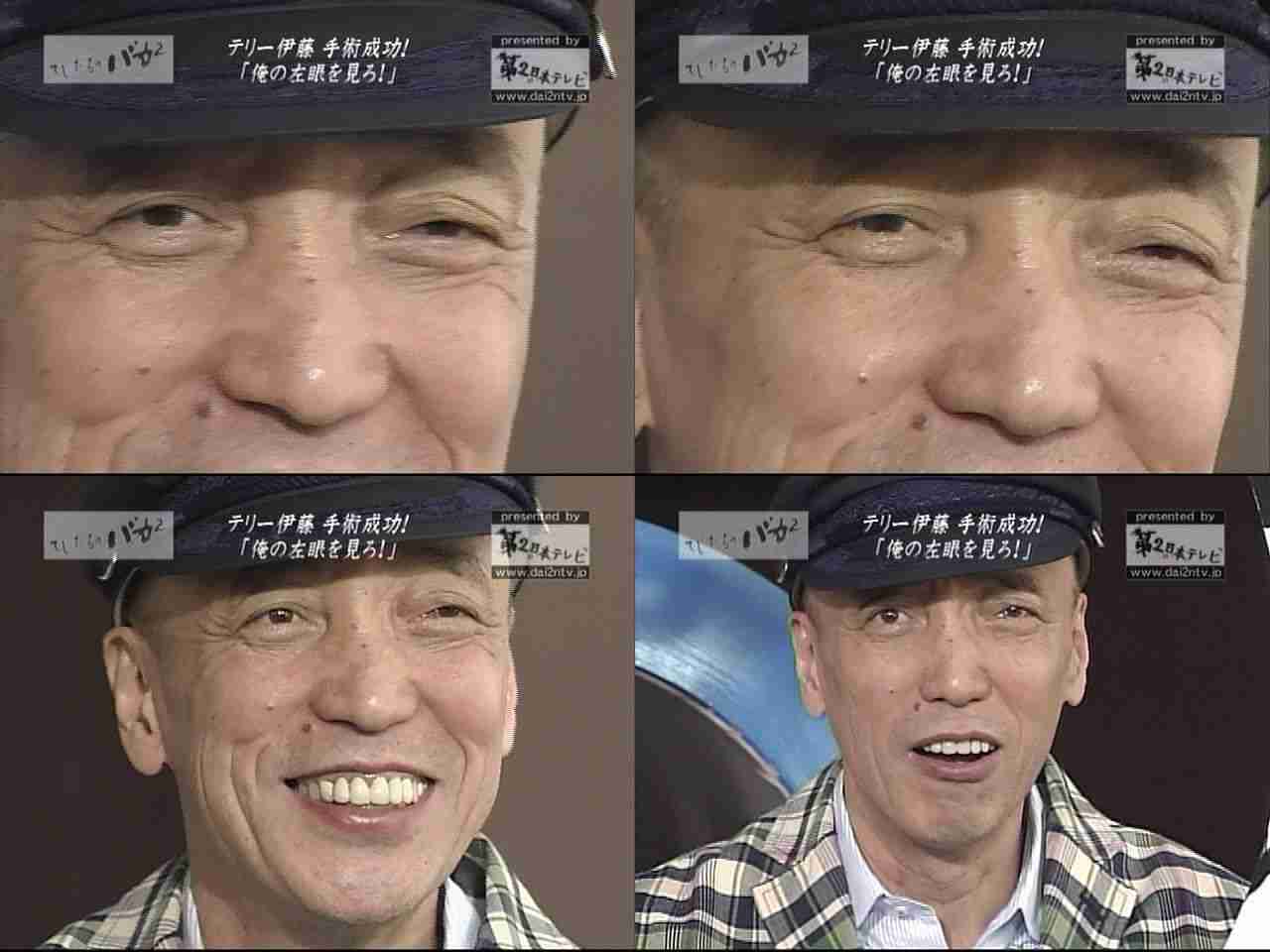 離れ目気味の人集まれ〜！