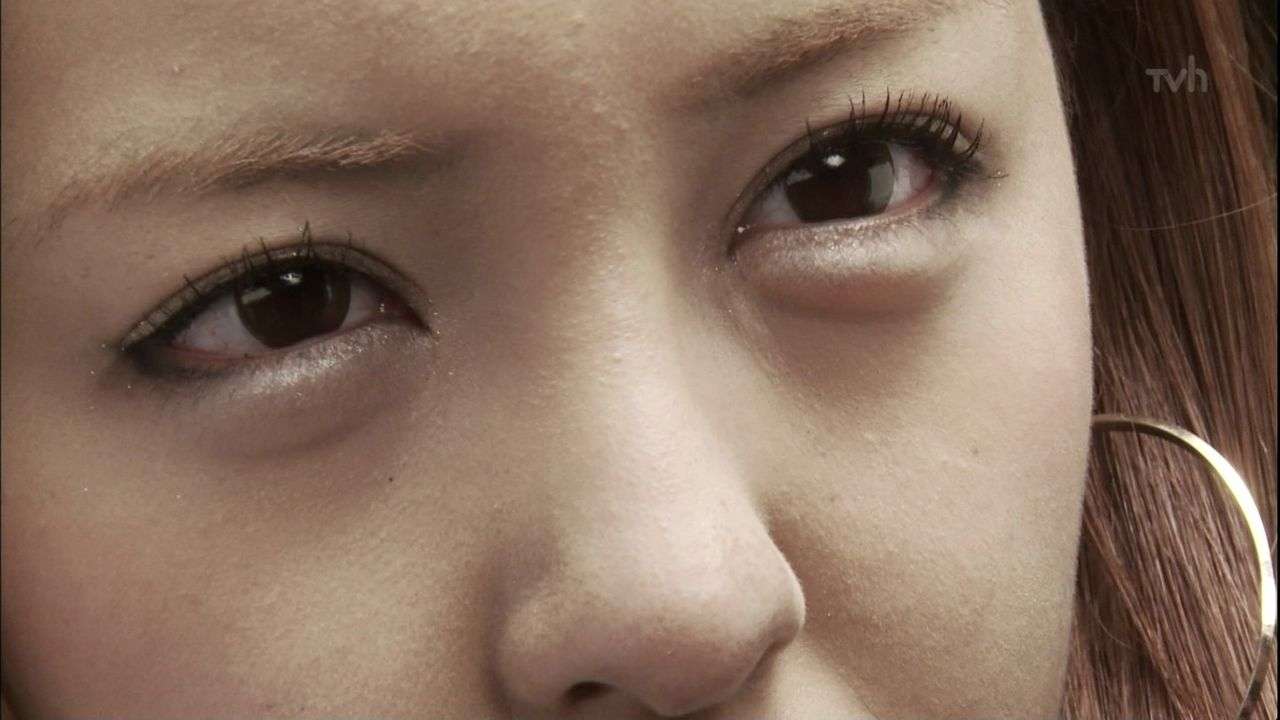 英国で韓国発“涙袋整形”ブームも、「ゾンビみたい」「オール明けの顔」とメディア酷評！