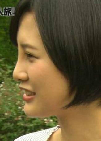 中国で美容整形ブーム加速 5歳の患者も!