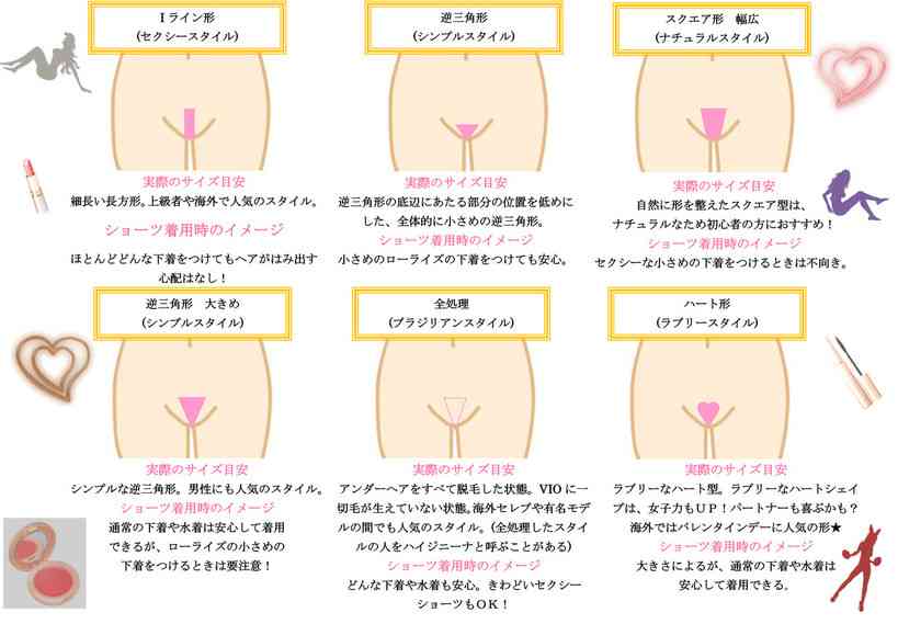 VIOの処理方法