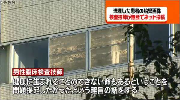臨床検査技師が流産した胎児写真を無断でツイッターに ガールズちゃんねる Girls Channel