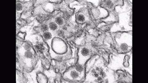 「ＷＨＯ、ジカ熱で緊急事態宣言」　News i - TBSの動画ニュースサイト