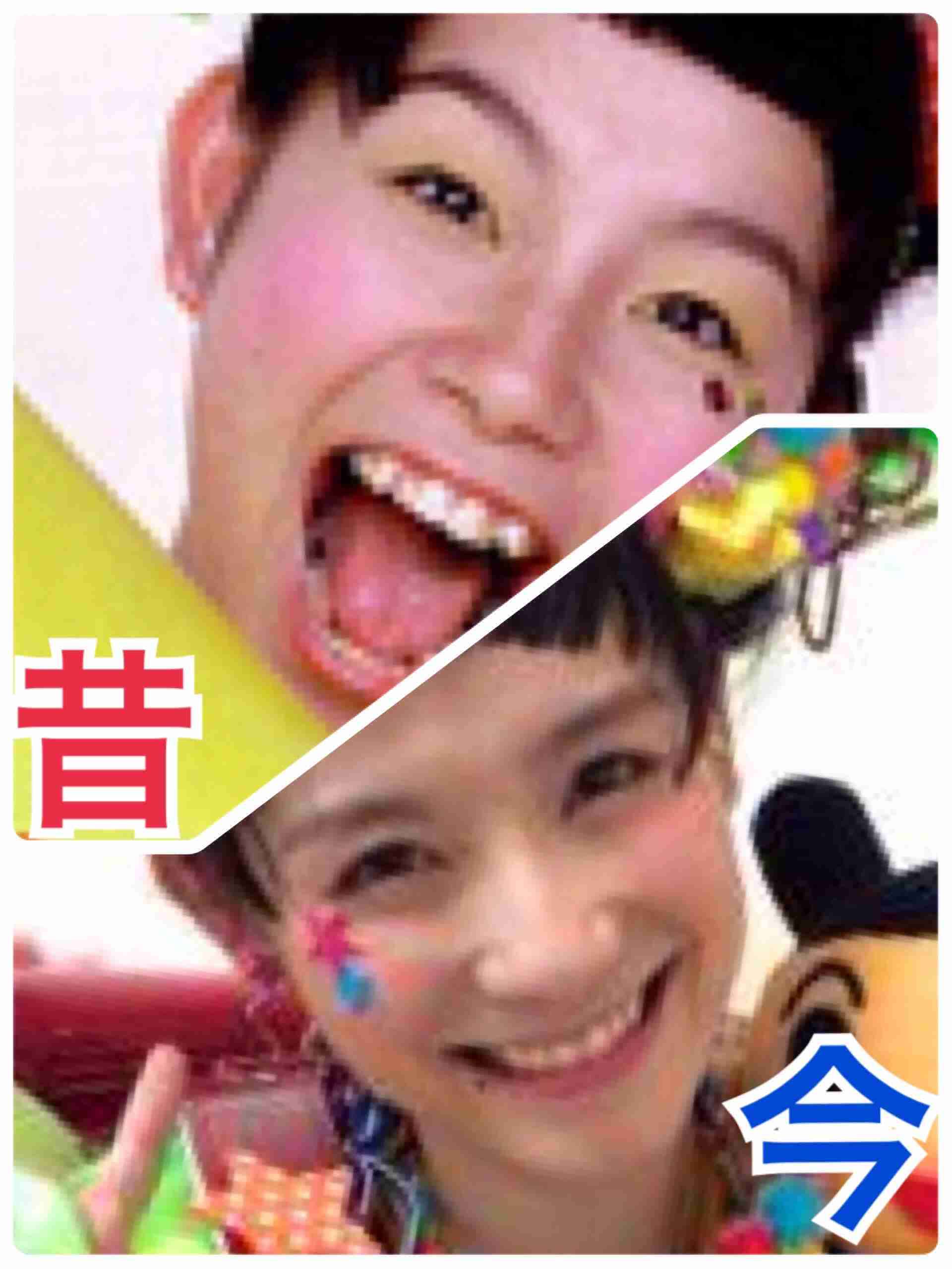 篠原ともえの“おでこ全開”ツインテールに「反則なほど可愛い」